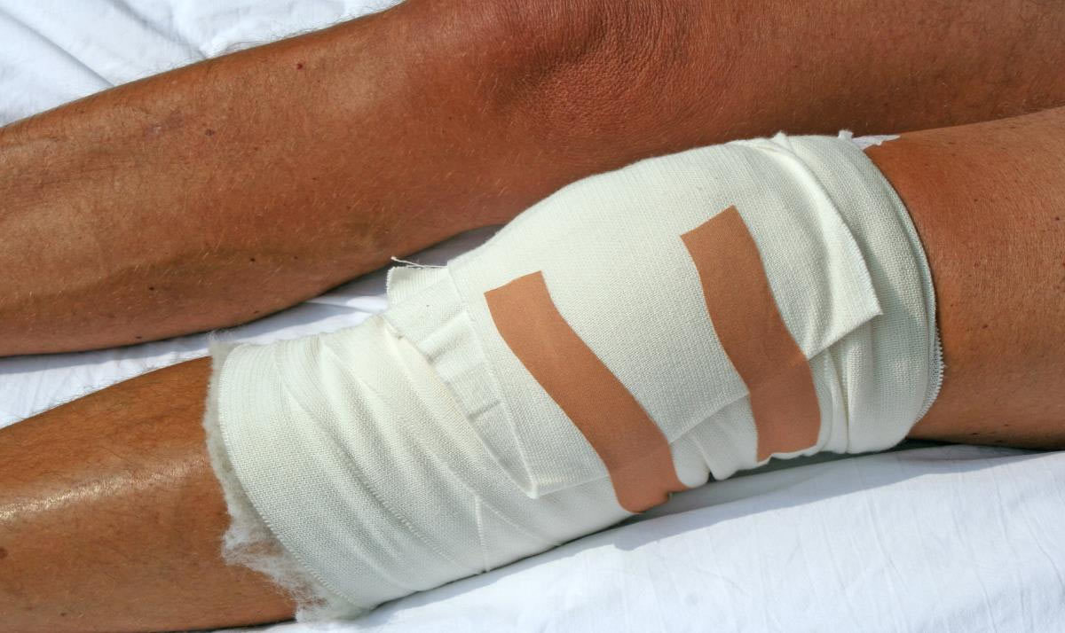 Total Knee Replacement Success Rates