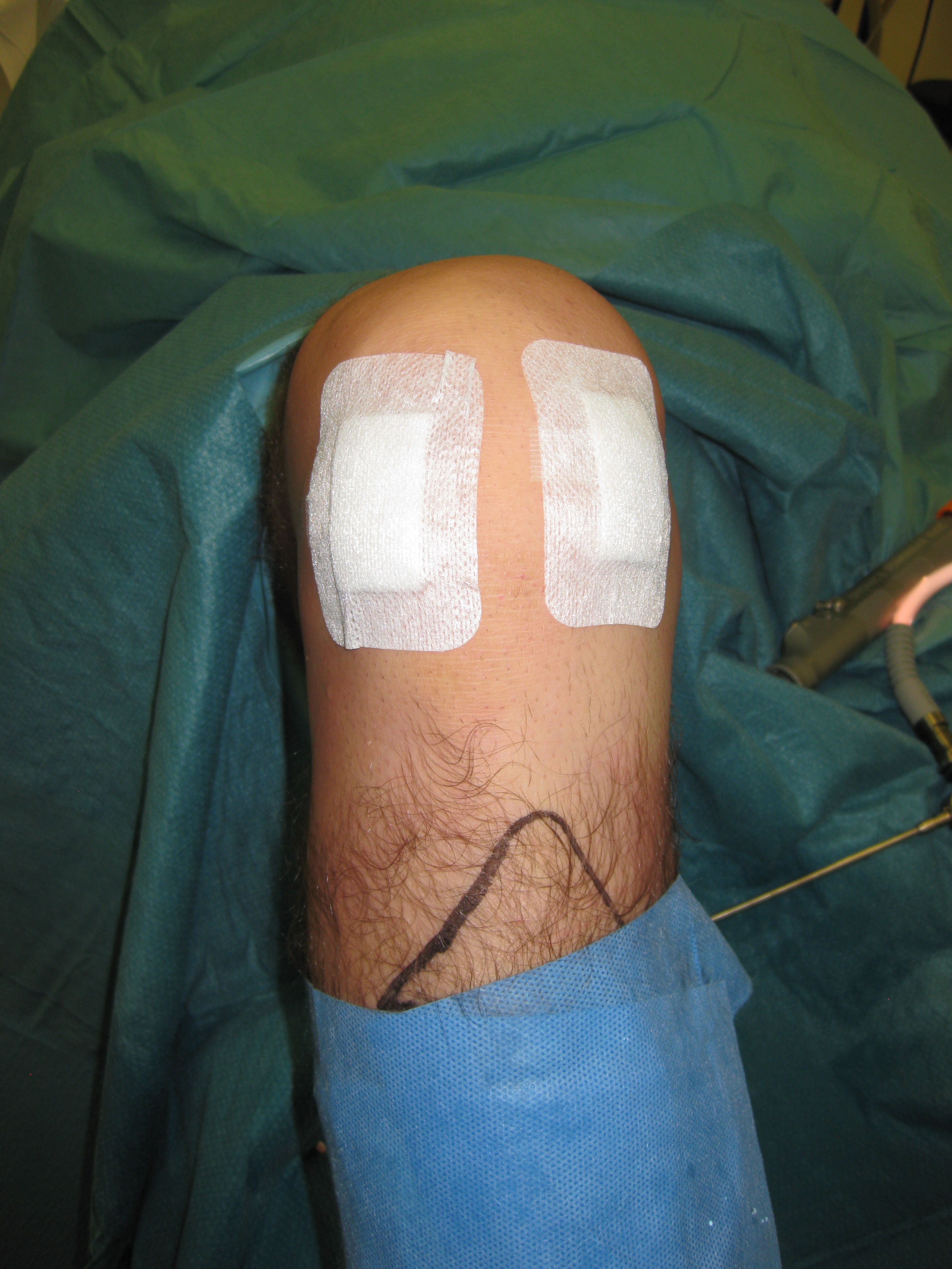 Knee Dressing After Arthroscopy